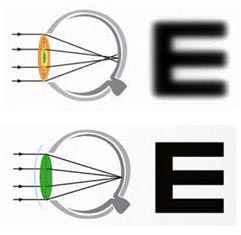 purevision2hd-spherical-abberation